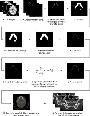 Reconstruction of Panoramic Dental Images Through Bézier Function Optimization